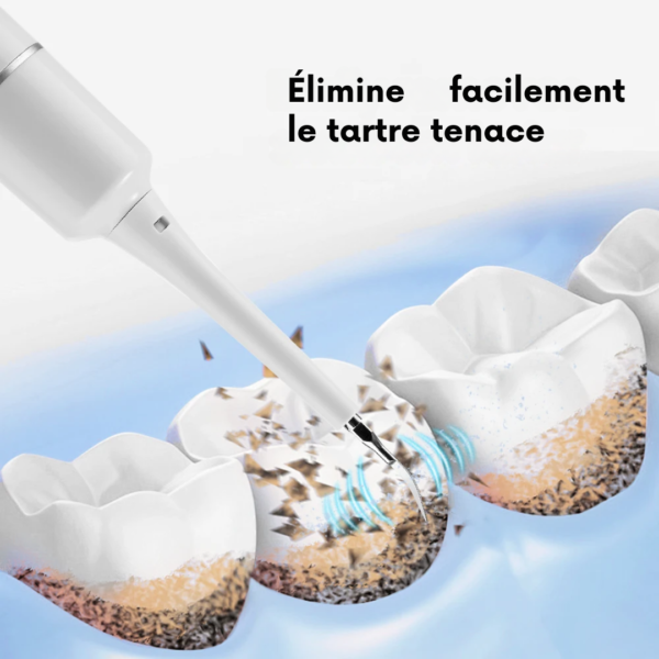 Grattoir dentaire ultrason puissant pour enlever le tartre dent et la plaque – comment enlever le tartre sur les dents efficacement chez soi