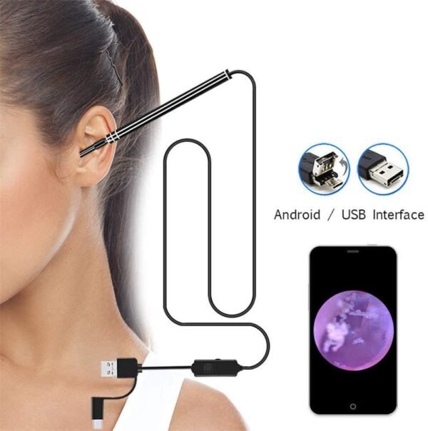 Endoscope Auriculaire Professionnel avec Caméra HD – Inspection des Oreilles et Nettoyage des Cérumen à Domicile