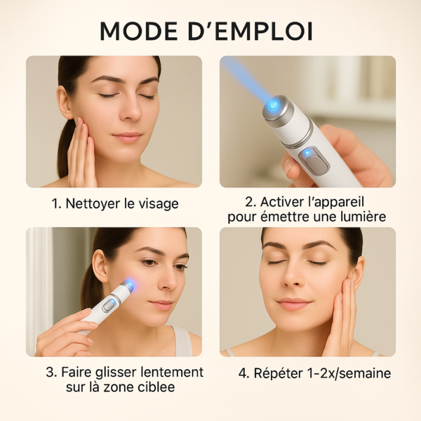 Stylo laser à lumière bleue pour taches, cicatrices et tatouages