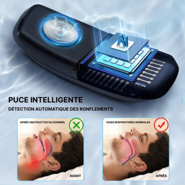 Appareil Anti Apnée du Sommeil : Solution Efficace pour Réduire le Ronflement et Améliorer la Qualité du Sommeil