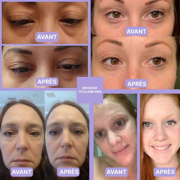 Frame-152-18.jpg Masseur Oculaire Anti-Cernes Électrique avec Lumière LED | Dispositif de Soin pour Yeux Fatigués et Cernes