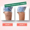 Appareil Anti-cellulite Masseur Intégré | Dispositif de Massage Électrique pour Réduction de Cellulite et Amélioration de la Circulation