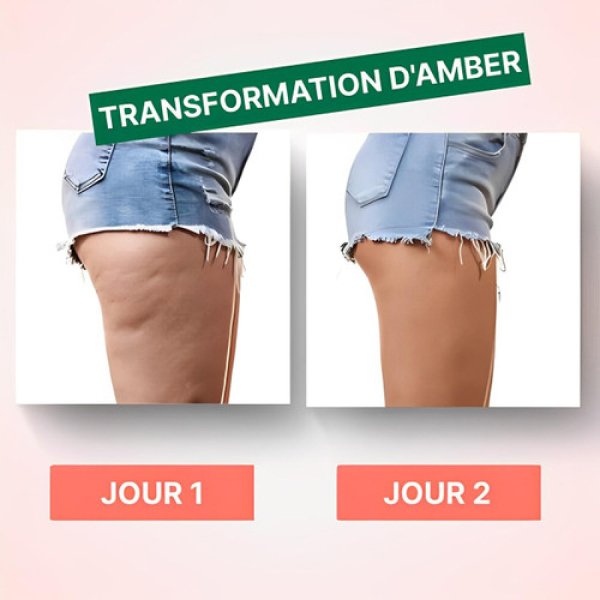 Appareil Anti-cellulite Masseur Intégré | Dispositif de Massage Électrique pour Réduction de Cellulite et Amélioration de la Circulation