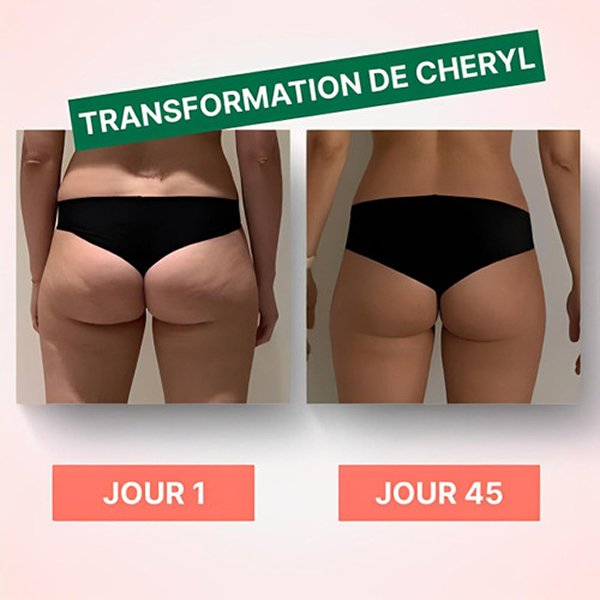 Appareil massant cellulite efficace à domicile avec massage profond, alternatif cellublue.