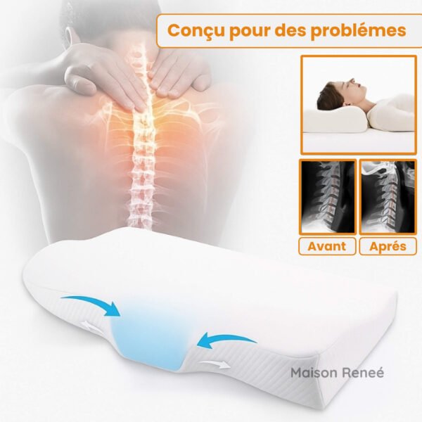 Oreiller ergonomique pour cervicales à mémoire de forme pour soulager les douleurs cervicales