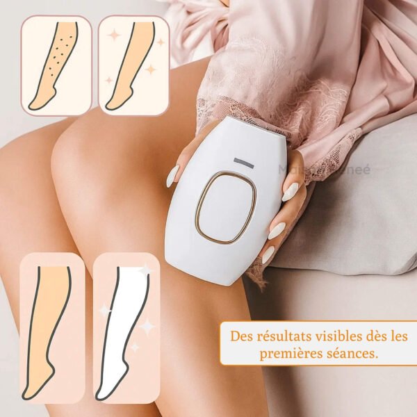 Frame-1984077932-1.jpg Épilateur lumière pulsée pour épilation définitive visage femme, usage maison type dermato