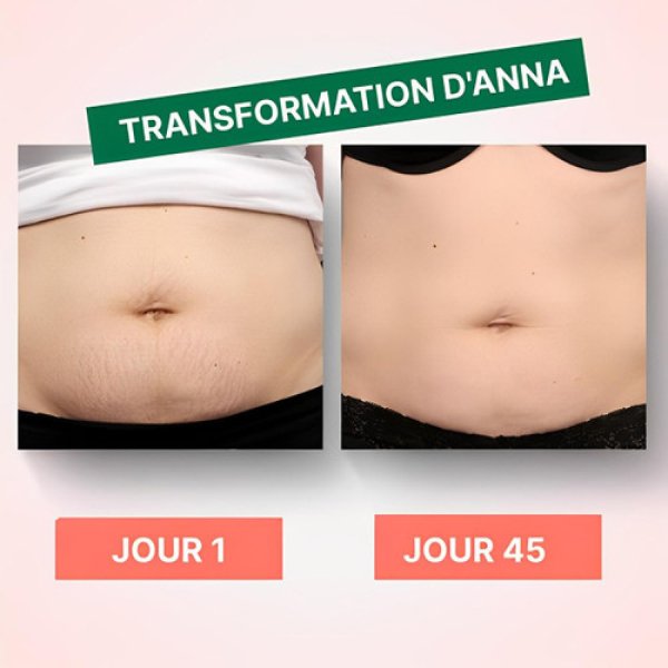 Appareil Anti-cellulite Masseur Intégré | Dispositif de Massage Électrique pour Réduction de Cellulite et Amélioration de la Circulation