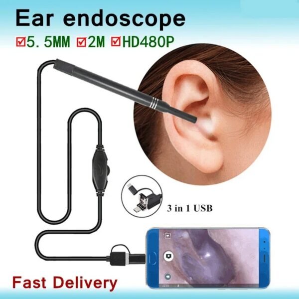 Endoscope Auriculaire Professionnel avec Caméra HD – Inspection des Oreilles et Nettoyage des Cérumen à Domicile