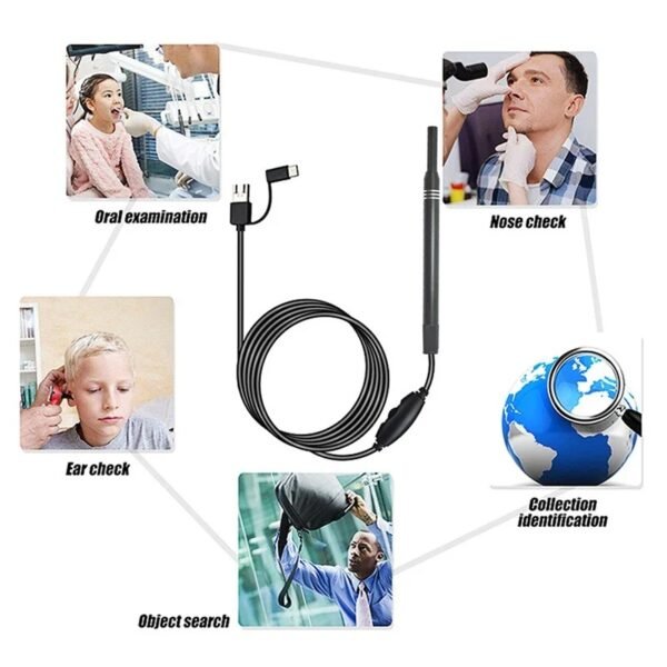 Endoscope Auriculaire Professionnel avec Caméra HD – Inspection des Oreilles et Nettoyage des Cérumen à Domicile