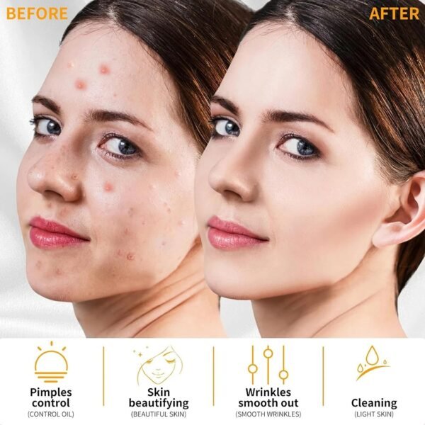 Appareil Haute Fréquence D’arsonval pour Soins de Beauté des Cheveux et de la Peau – Traitement Anti-Acné et Anti-Rides à Domicile