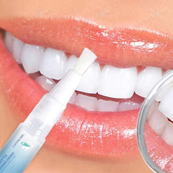 Stylo Blanchisseur de Dents – White Teeth