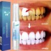 Stylo Blanchisseur de Dents – White Teeth