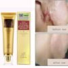 Crème anti-cicatrices régénératrice