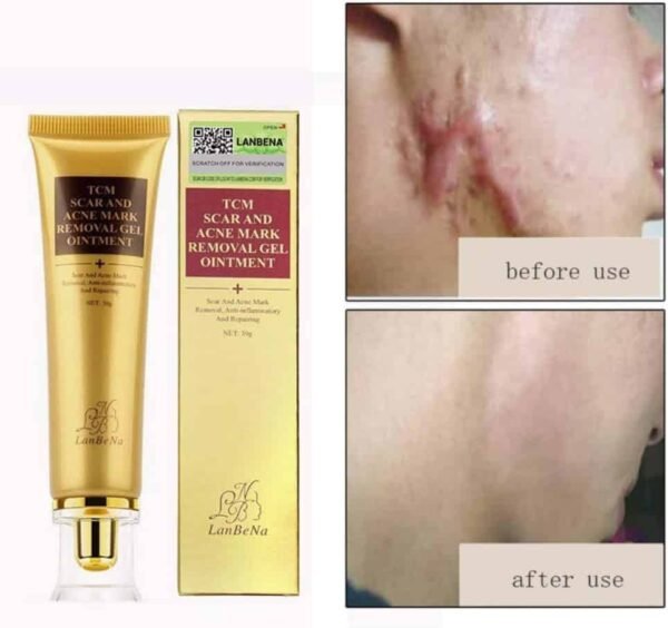 Crème anti-cicatrices régénératrice