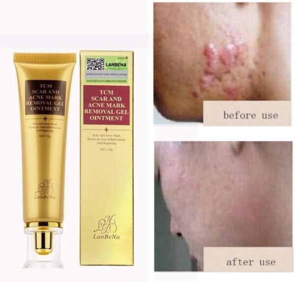 Crème anti-cicatrices régénératrice