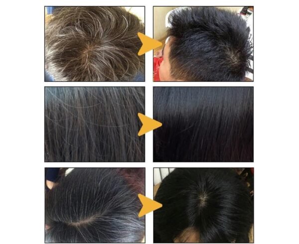 Soin Shampoing anti cheveux blancs