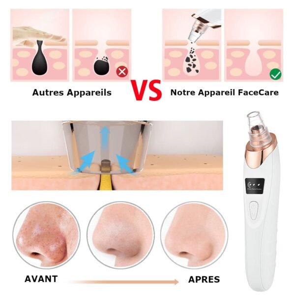 Aspirateur à Points Noirs | Nettoyeur de pores FaceCare