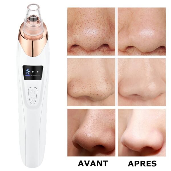 Aspirateur à Points Noirs | Nettoyeur de pores FaceCare