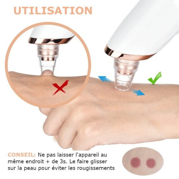 Aspirateur à Points Noirs | Nettoyeur de pores FaceCare