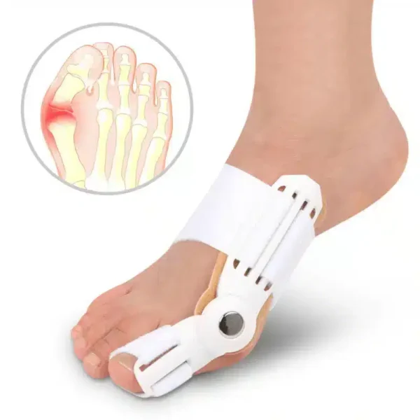 Correcteur Hallux Valgus Efficace | Orthèse