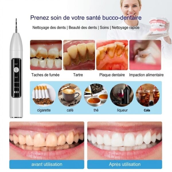 Détartreur dentaire à Ultrasons avec caméra