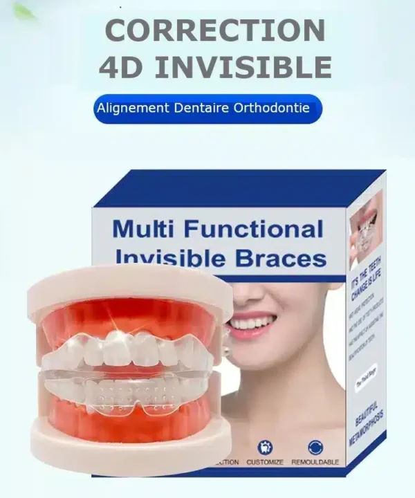 Gouttière de réalignement dentaire invisible