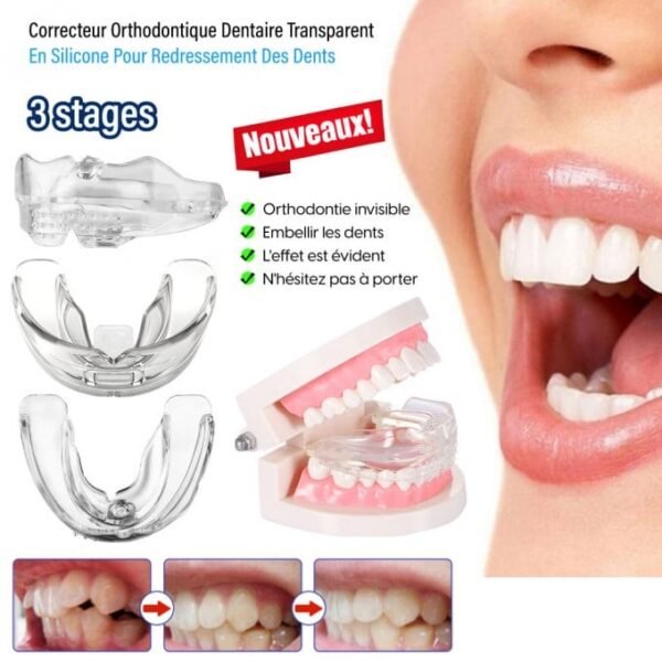 Gouttière de réalignement dentaire invisible