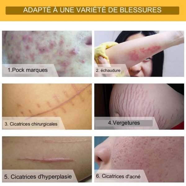 Crème anti-cicatrices régénératrice