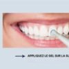 Stylo Blanchisseur de Dents – White Teeth
