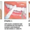 Stylo Blanchisseur de Dents – White Teeth