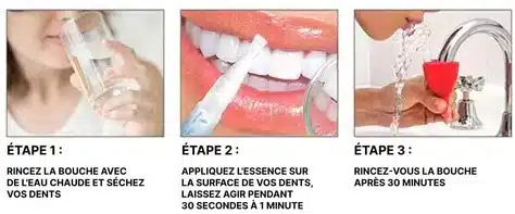 Stylo Blanchisseur de Dents – White Teeth