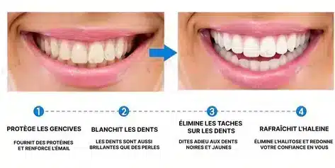 Stylo Blanchisseur de Dents – White Teeth